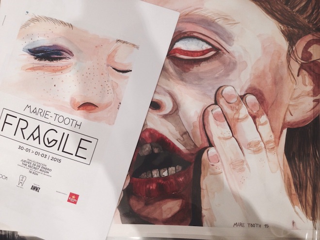 fragile marie tooth expo