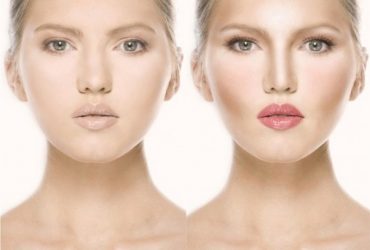 Contouring-nose Before-and-After